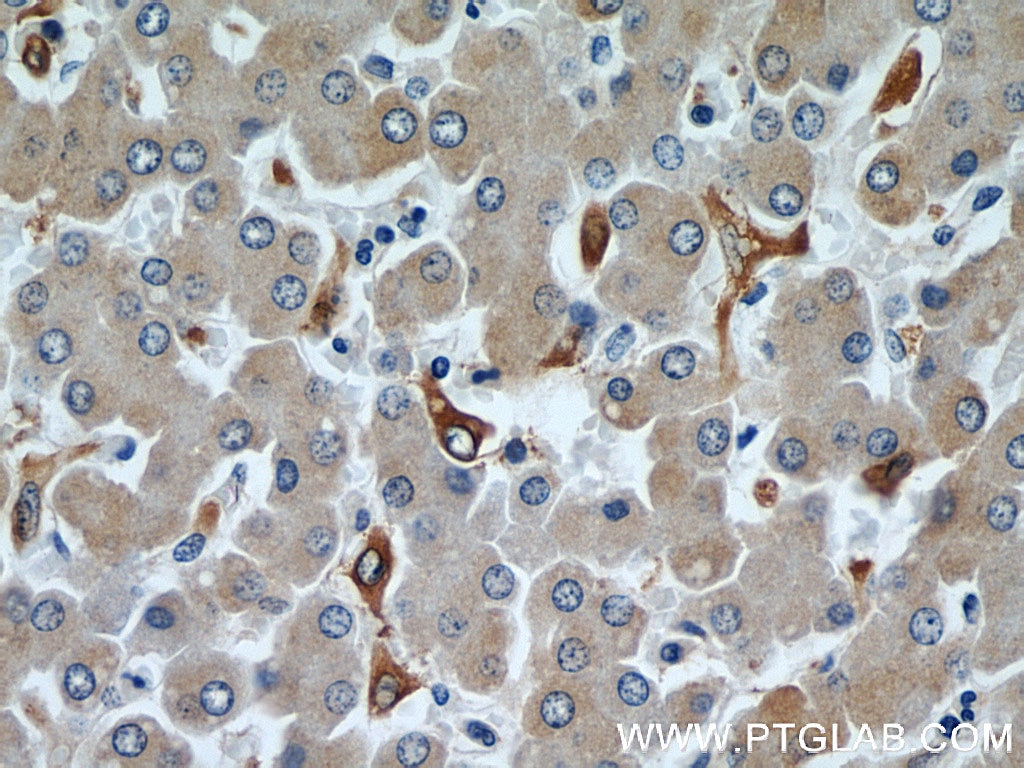 Immunohistochemistry (IHC) staining of human liver tissue using HADHA Monoclonal antibody (60250-1-Ig)