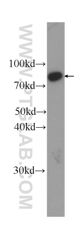 Western Blot (WB) analysis of HepG2 cells using HADHA Monoclonal antibody (60250-1-Ig)