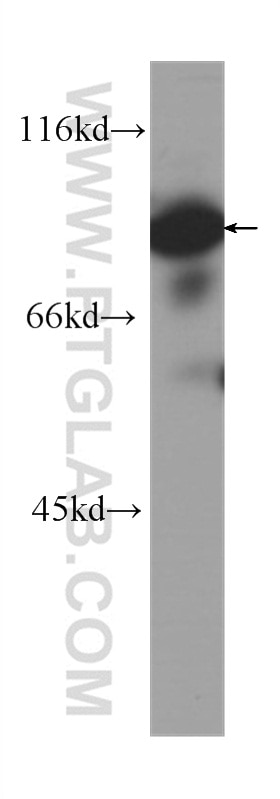 Western Blot (WB) analysis of Jurkat cells using HADHA Monoclonal antibody (60250-1-Ig)