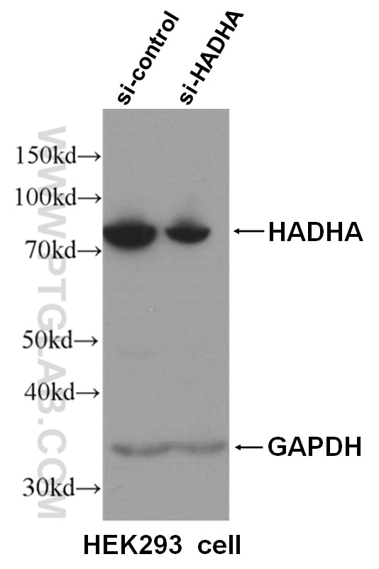 Western Blot (WB) analysis of HEK293 cells using HADHA Monoclonal antibody (60250-1-Ig)