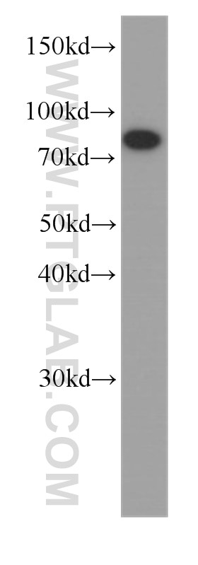 Western Blot (WB) analysis of A375 cells using HADHA Monoclonal antibody (60250-1-Ig)
