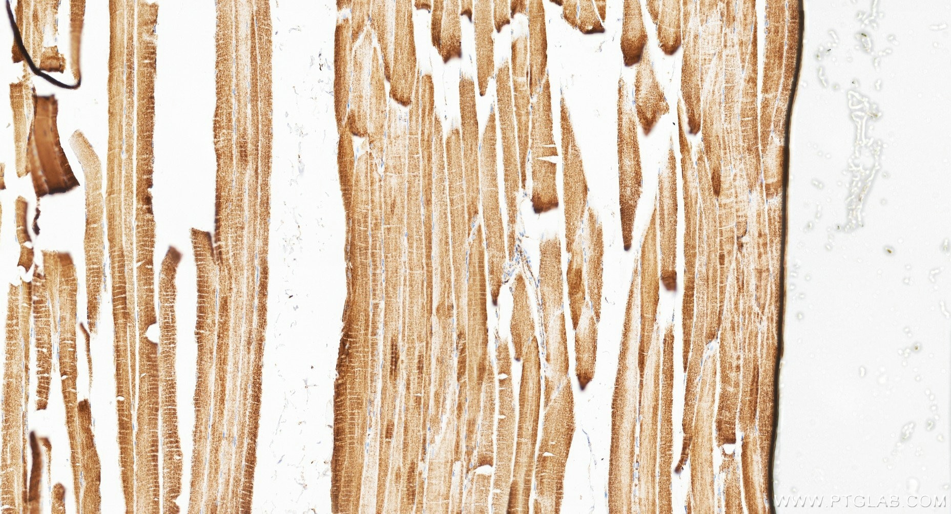 IHC staining of human skeletal muscle using 87032-3-RR (same clone as 87032-3-PBS) Immunohistochemistry (IHC) staining of human skeletal muscle tissue using HADHA Recombinant monoclonal antibody (87032-3-RR)