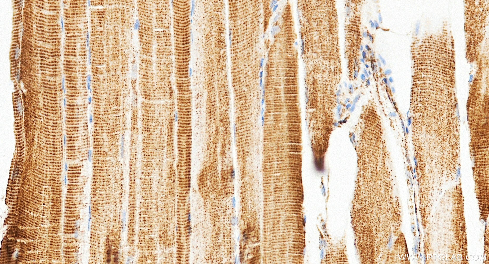 IHC staining of human skeletal muscle using 87032-3-RR (same clone as 87032-3-PBS) Immunohistochemistry (IHC) staining of human skeletal muscle tissue using HADHA Recombinant monoclonal antibody (87032-3-RR)