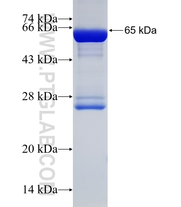 HADHA fusion protein Ag1211 SDS-PAGE
