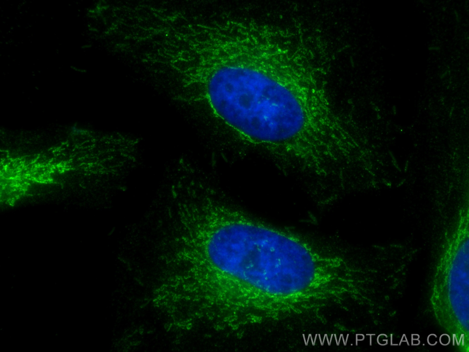 Immunofluorescence (IF) / fluorescent staining of HeLa cells using HADHB Monoclonal antibody (67967-1-Ig)