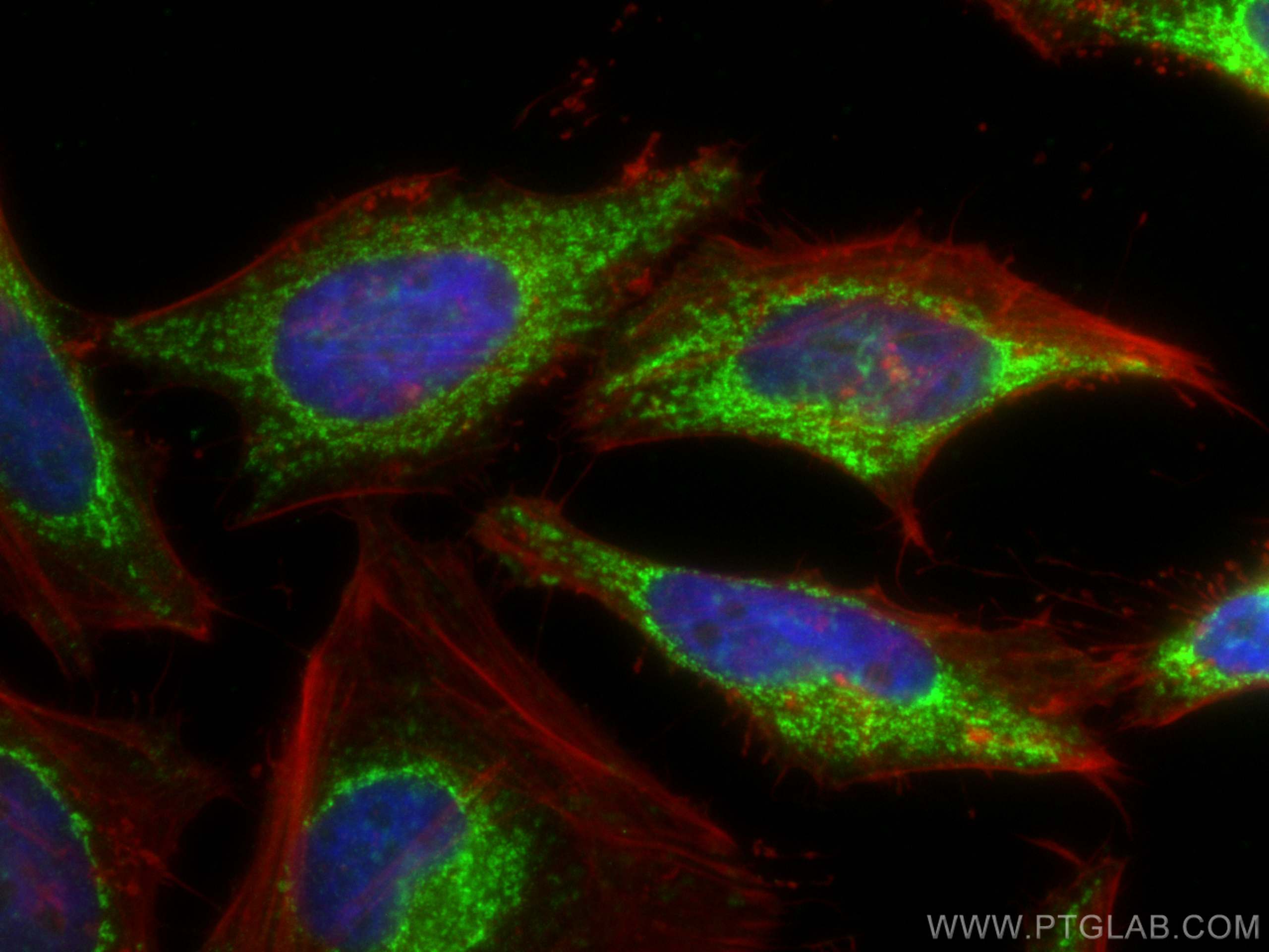 Immunofluorescence (IF) / fluorescent staining of HeLa cells using HADHB Monoclonal antibody (67967-1-Ig)