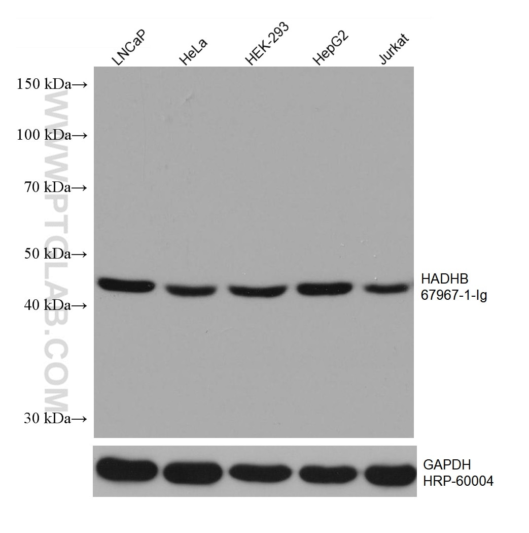 Western Blot (WB) analysis of various lysates using HADHB Monoclonal antibody (67967-1-Ig)