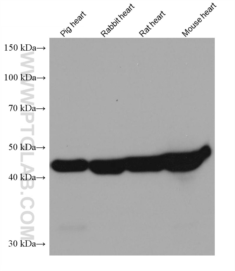 Western Blot (WB) analysis of various lysates using HADHB Monoclonal antibody (67967-1-Ig)