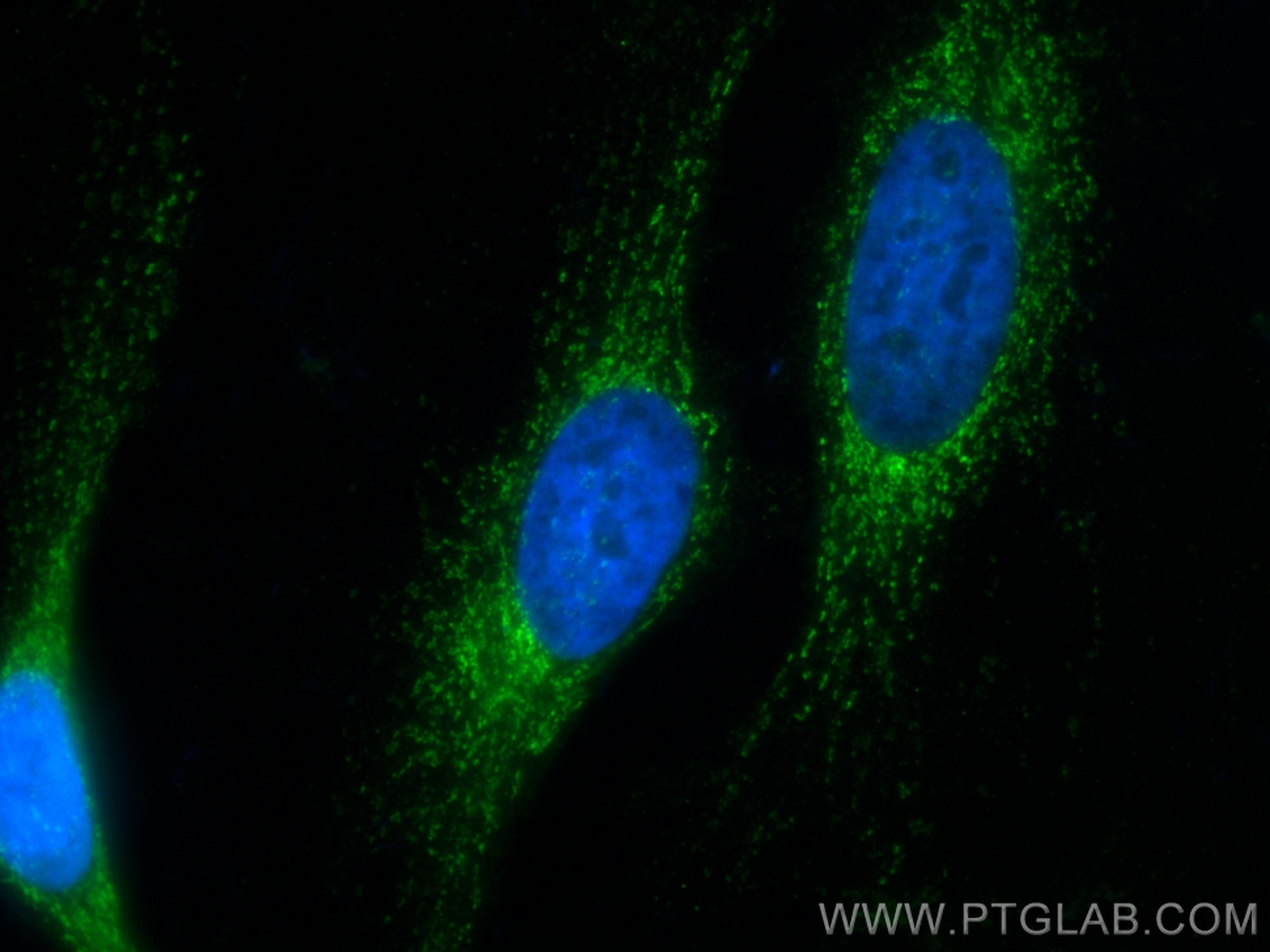 Immunofluorescence (IF) / fluorescent staining of HeLa cells using CoraLite® Plus 488-conjugated HADHB Monoclonal ant (CL488-67967)