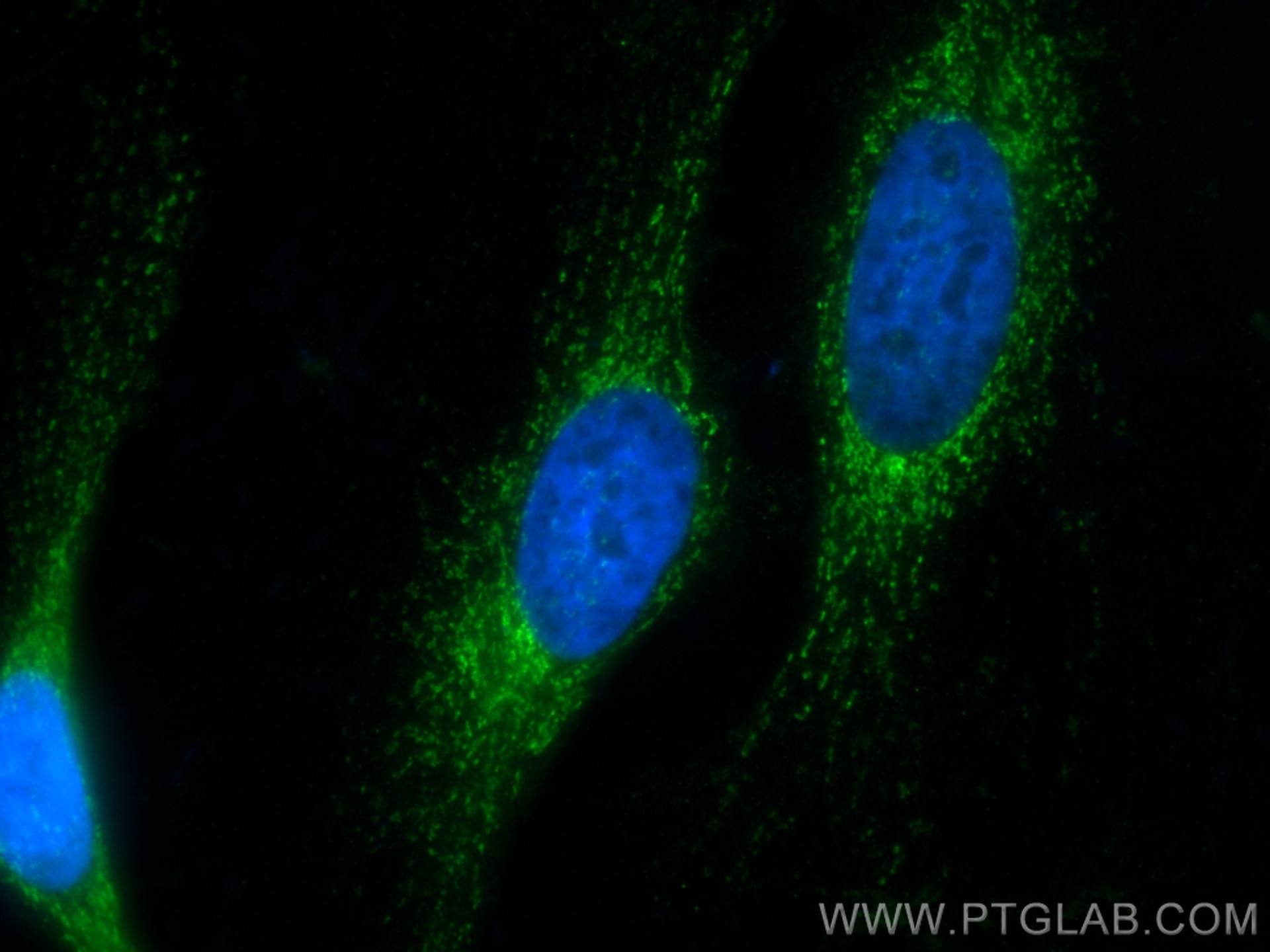 IF Staining of HeLa using CL488-67967