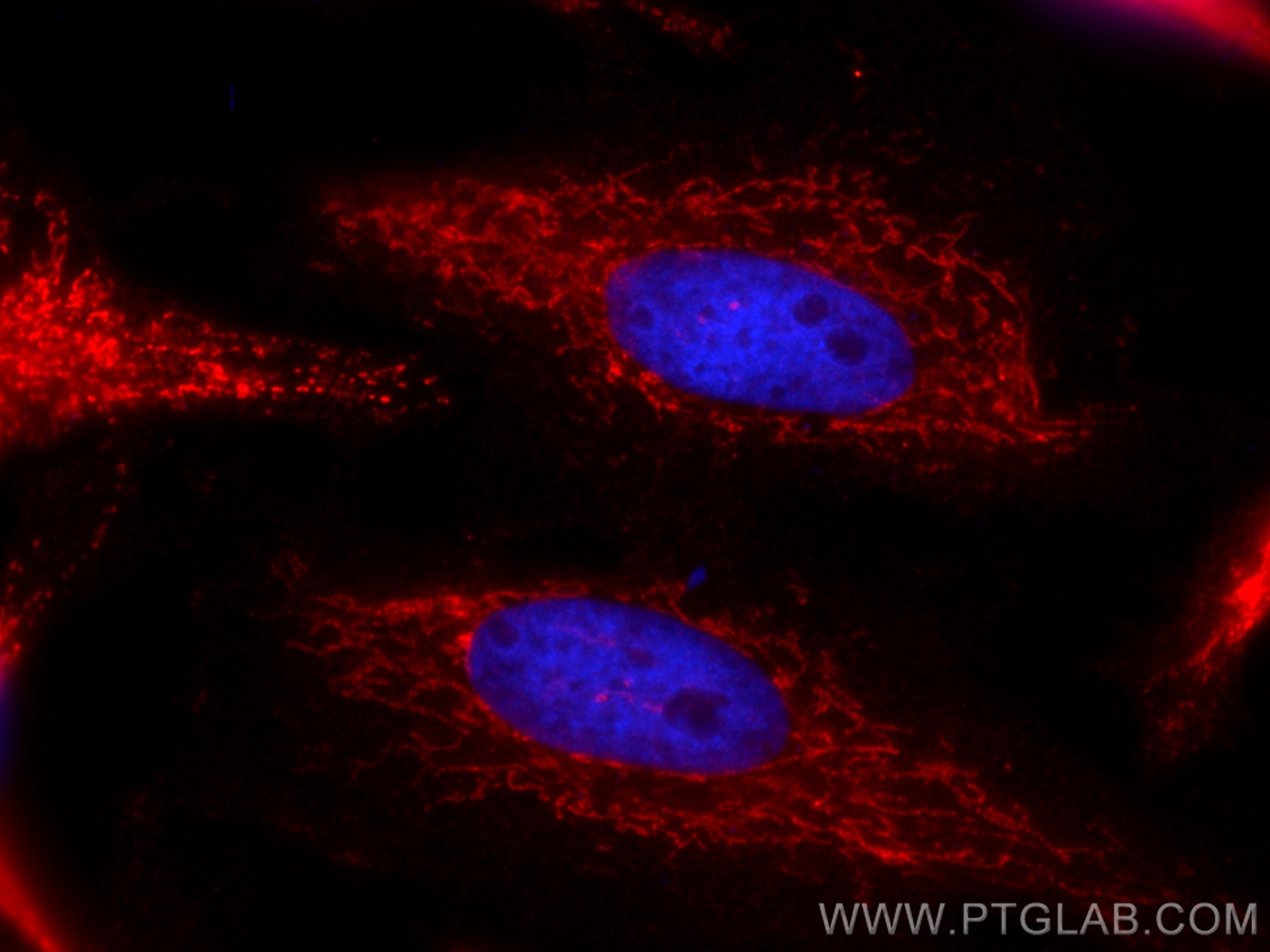 Immunofluorescence (IF) / fluorescent staining of HeLa cells using CoraLite®594-conjugated HADHB Monoclonal antibody (CL594-67967)