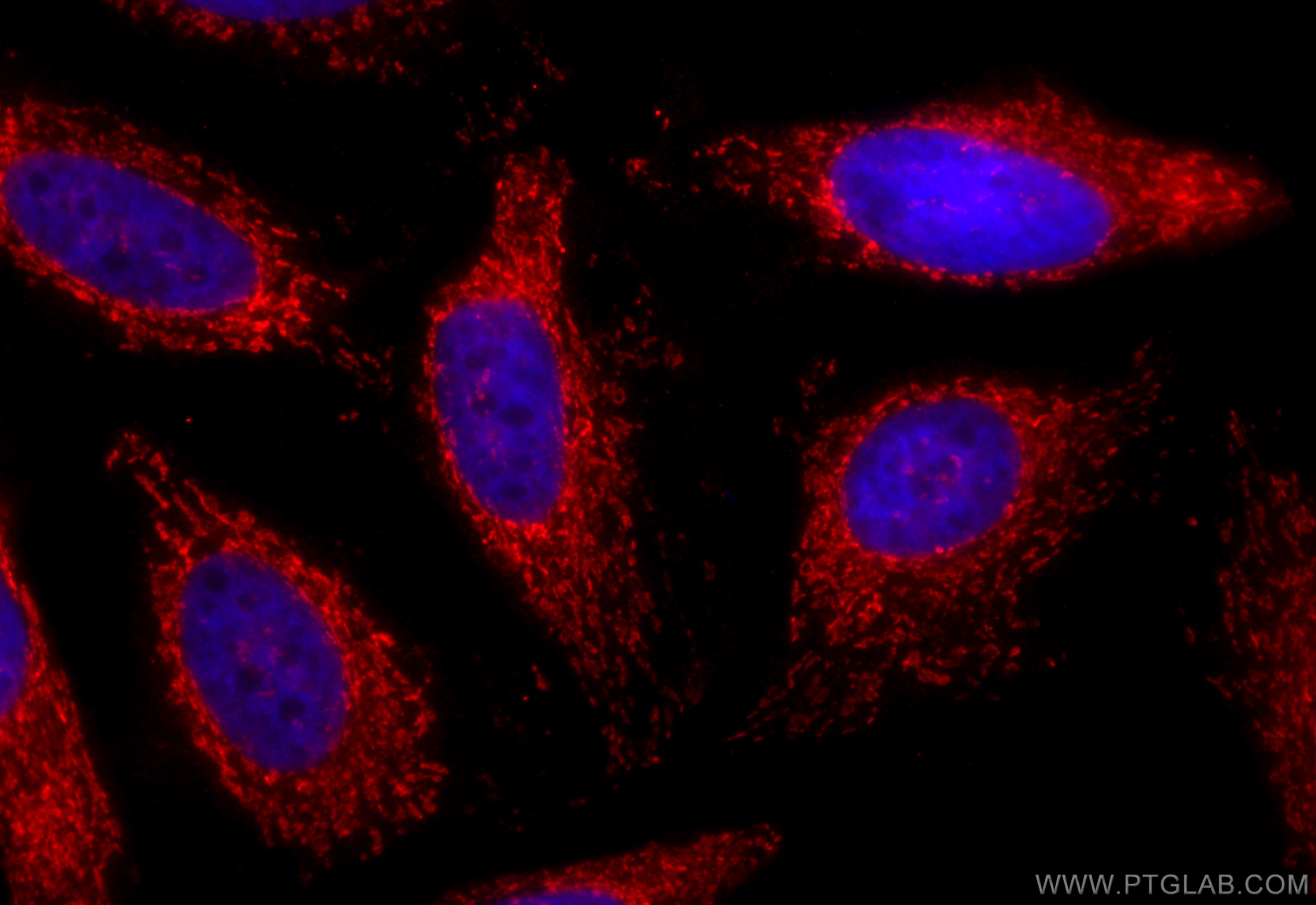Immunofluorescence (IF) / fluorescent staining of HeLa cells using CoraLite®594-conjugated HADHB Monoclonal antibody (CL594-67967)