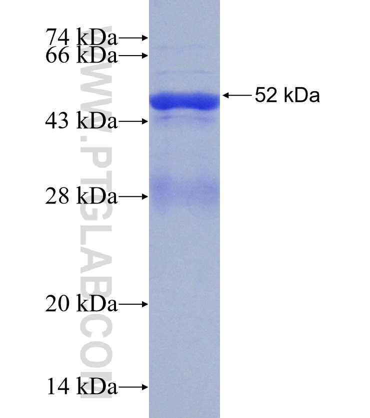 HADHB fusion protein Ag30298 SDS-PAGE