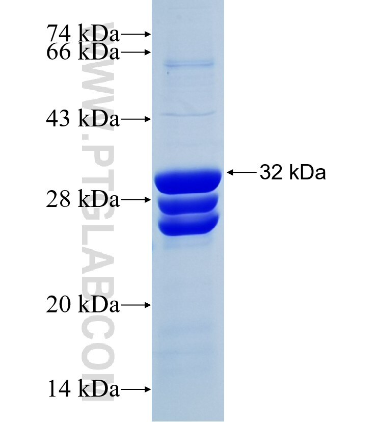 HADHB fusion protein Ag30315 SDS-PAGE