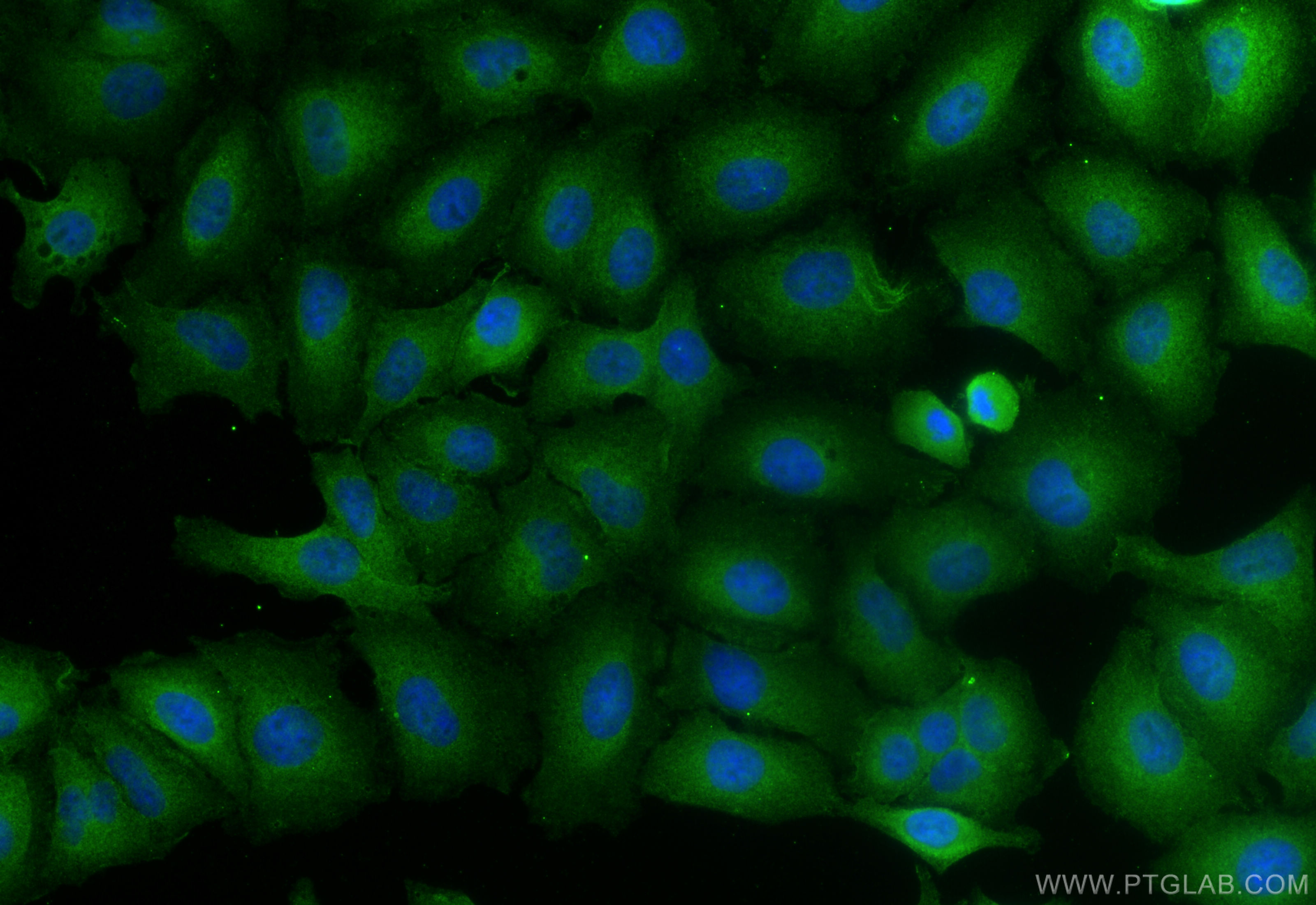 Immunofluorescence (IF) / fluorescent staining of A549 cells using GLO2 Polyclonal antibody (17196-1-AP)