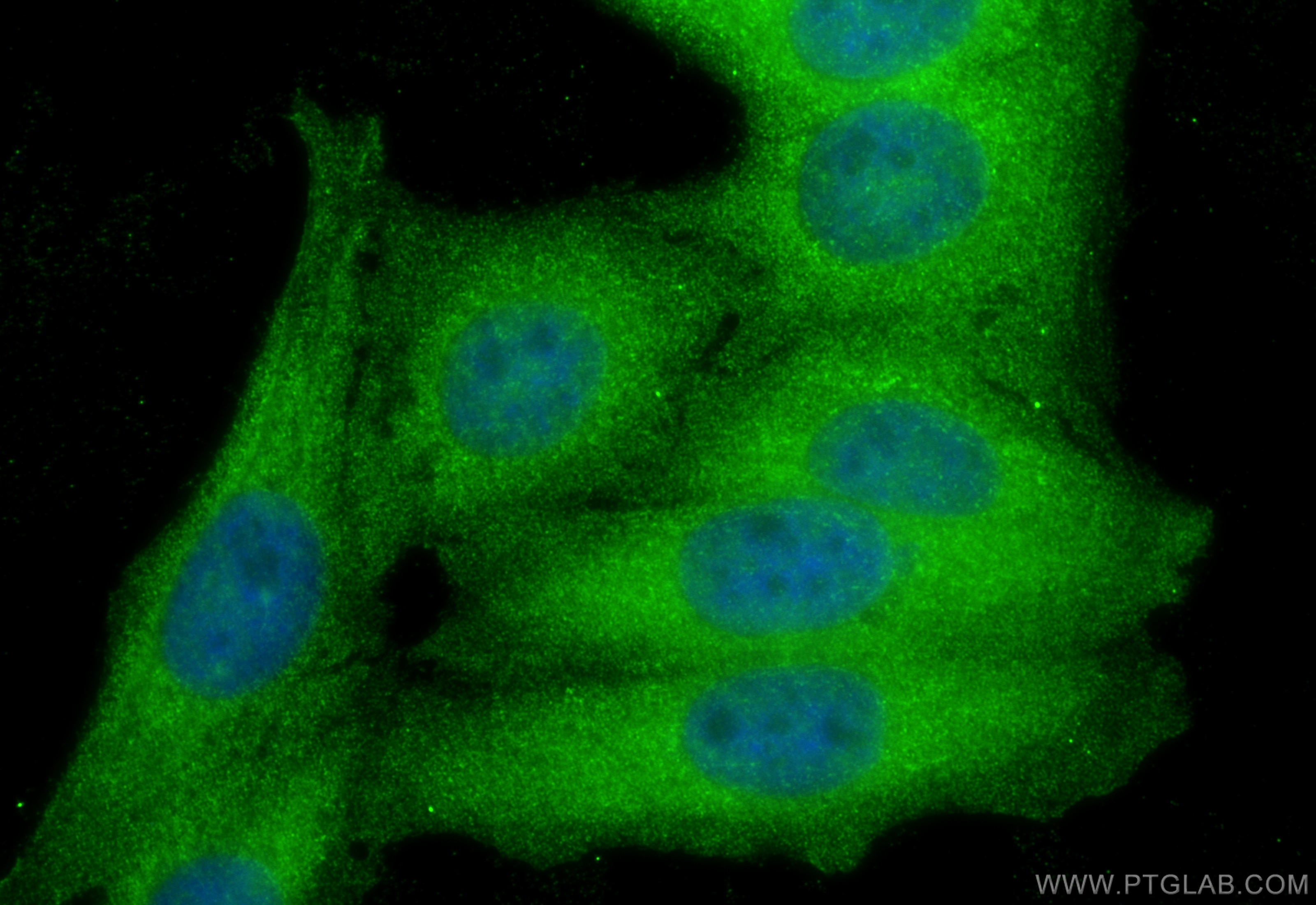 IF Staining of HepG2 using 17196-1-AP Immunofluorescence (IF) / fluorescent staining of HepG2 cells using GLO2 Polyclonal antibody (17196-1-AP)