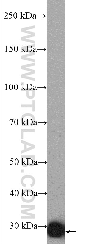 Western Blot (WB) analysis of mouse brain tissue using HAGH Polyclonal antibody (17196-1-AP)