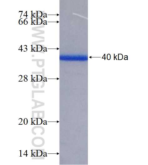 HAGH fusion protein Ag25812 SDS-PAGE