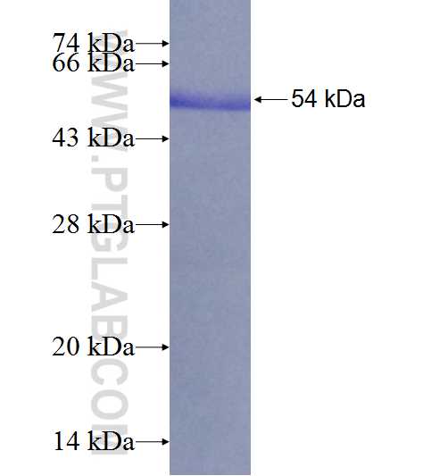 HAGH fusion protein Ag9998 SDS-PAGE