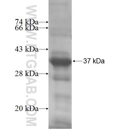 HAGHL fusion protein Ag7725 SDS-PAGE