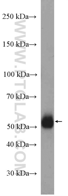 Western Blot (WB) analysis of MCF-7 cells using HAI-1 Polyclonal antibody (27593-1-AP)