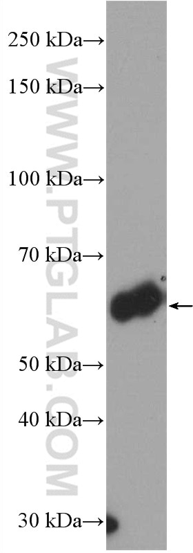 Western Blot (WB) analysis of human placenta tissue using HAI-1 Polyclonal antibody (27593-1-AP)