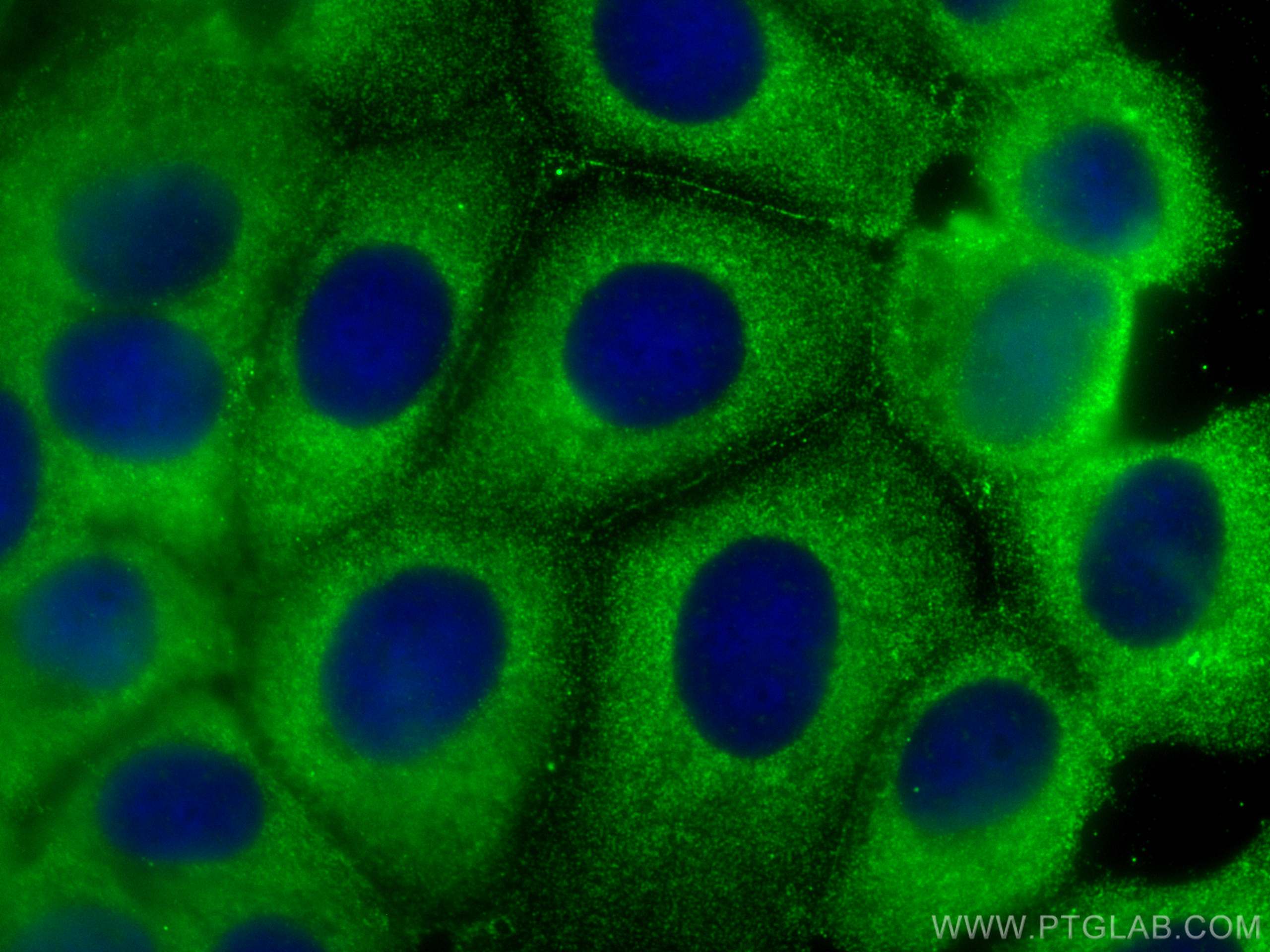 Immunofluorescence (IF) / fluorescent staining of MCF-7 cells using HAI-1 Monoclonal antibody (67031-1-Ig)