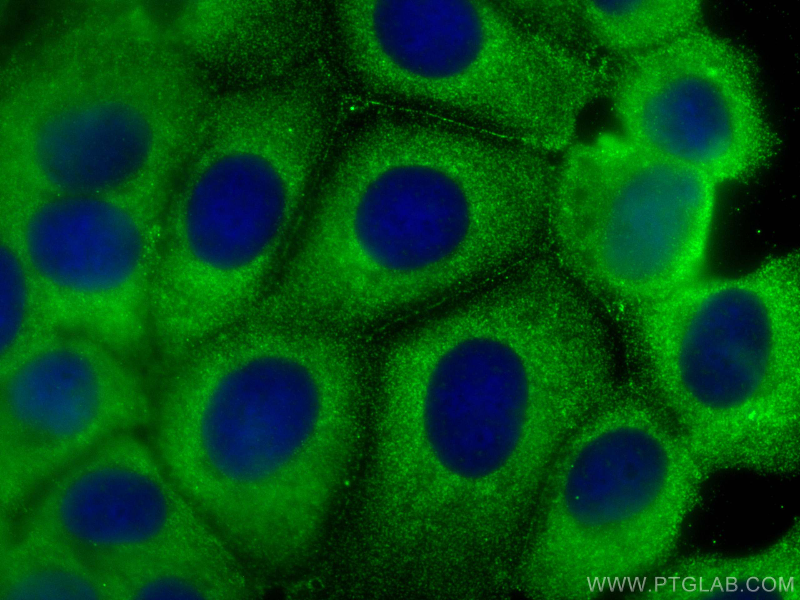 IF Staining of MCF-7 using 67031-1-Ig