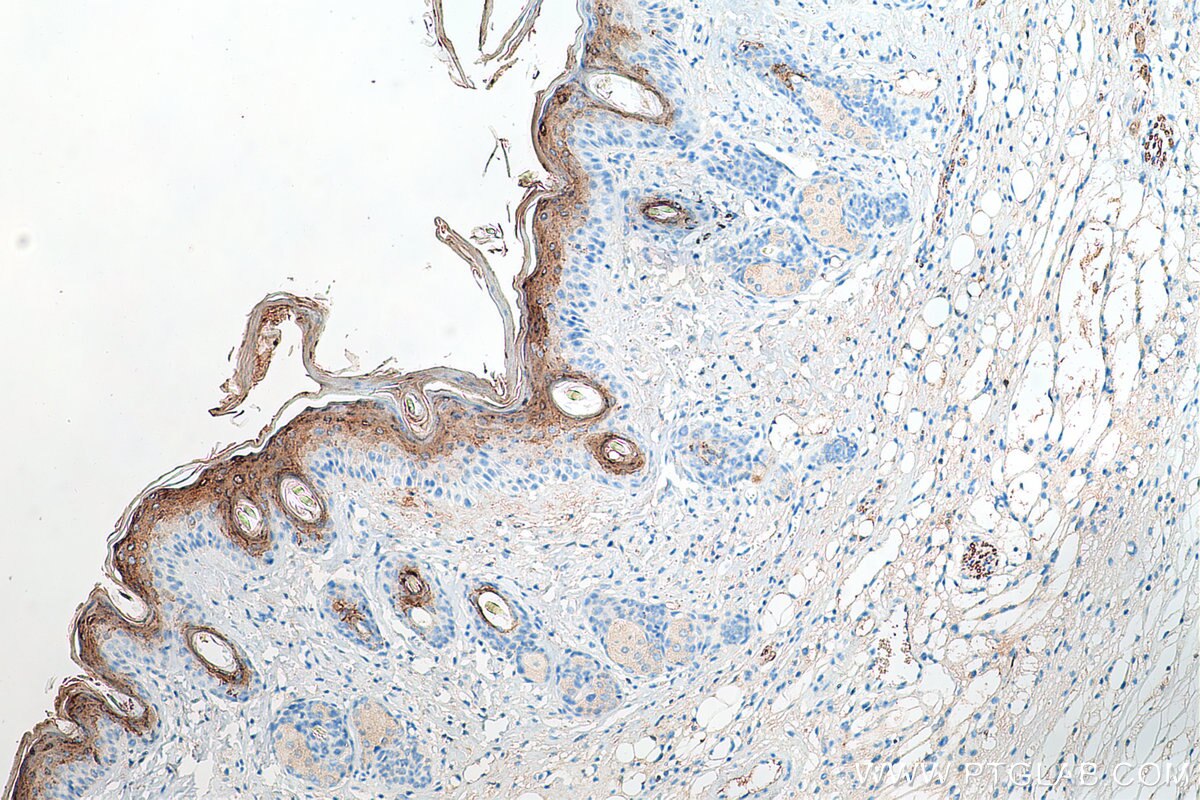 Immunohistochemistry (IHC) staining of mouse skin tissue using HAL Polyclonal antibody (25940-1-AP)