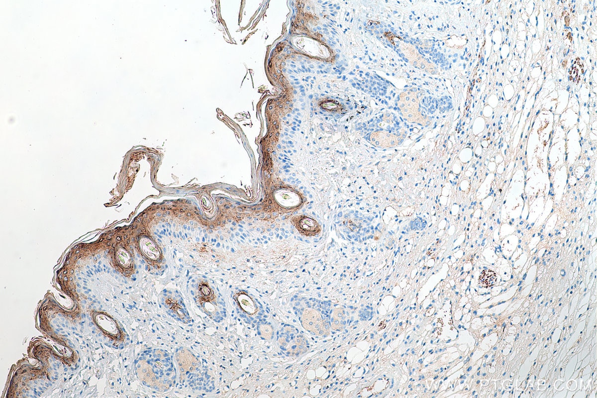 IHC staining of mouse skin using 25940-1-AP