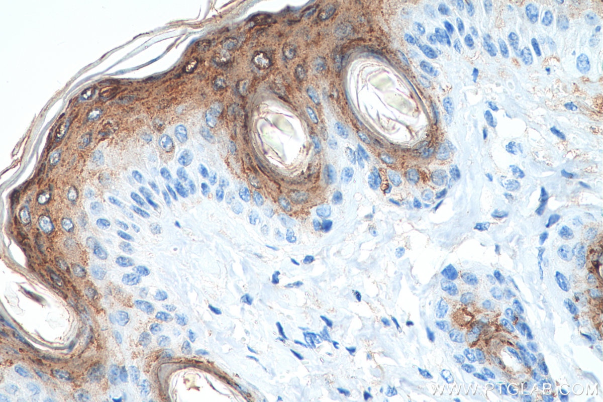 IHC staining of mouse skin using 25940-1-AP