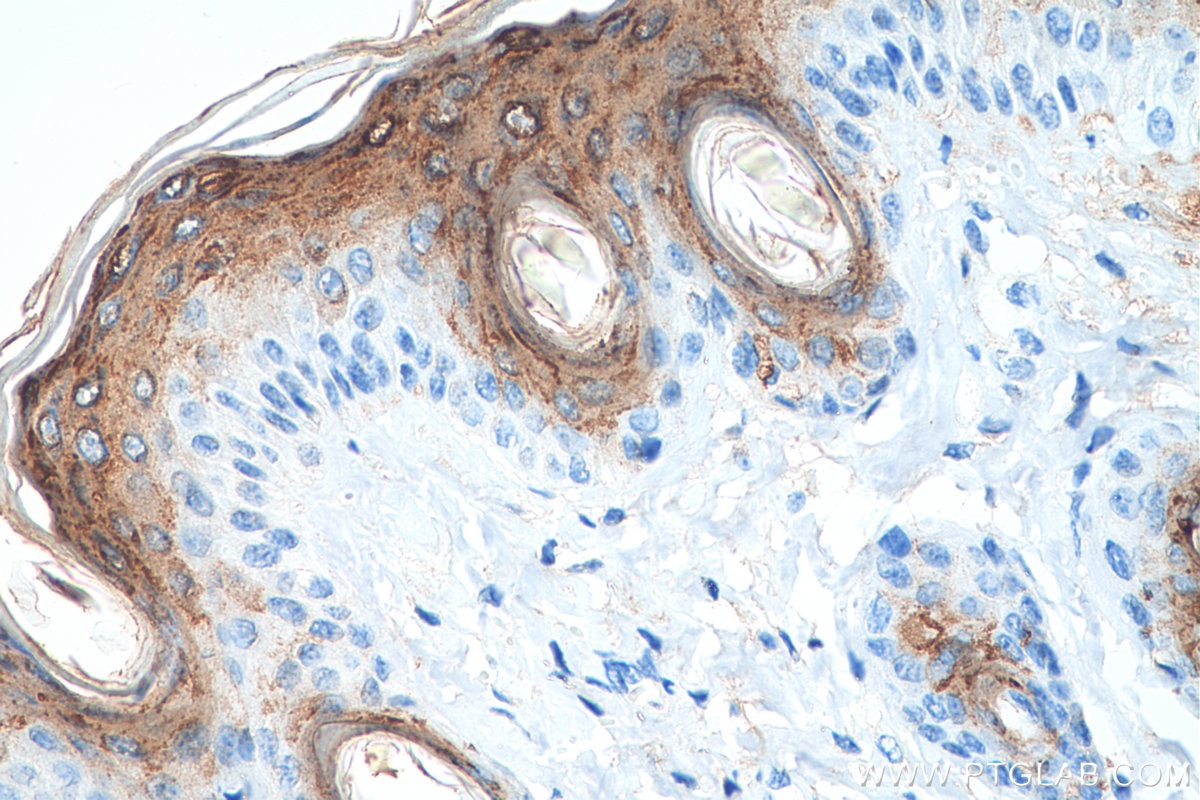 Immunohistochemistry (IHC) staining of mouse skin tissue using HAL Polyclonal antibody (25940-1-AP)