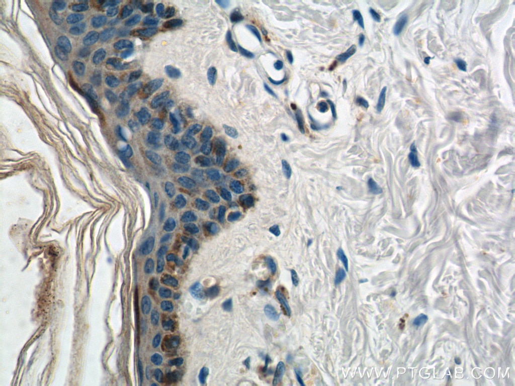 Immunohistochemistry (IHC) staining of human skin tissue using HAL Polyclonal antibody (25940-1-AP)