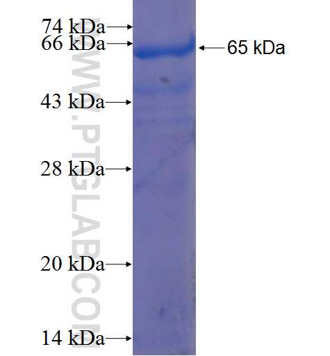HAL fusion protein Ag22985 SDS-PAGE