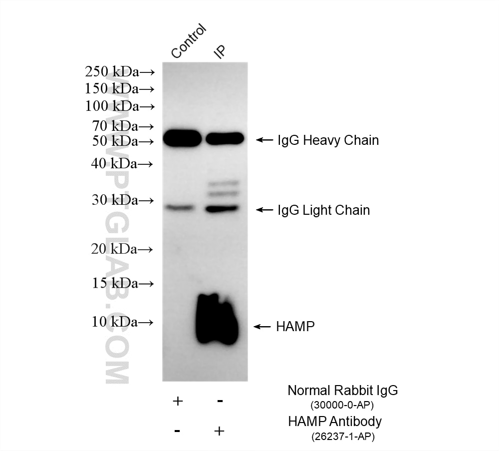 IP experiment of HepG2 using 26237-1-AP Immunoprecipitation (IP) experiment of HepG2 cells using HAMP Polyclonal antibody (26237-1-AP)