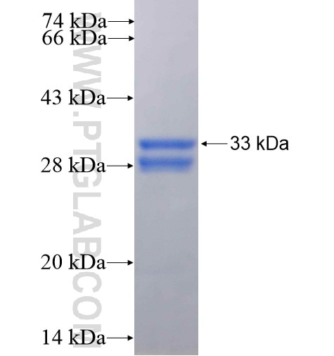 HAND2 fusion protein Ag16038 SDS-PAGE