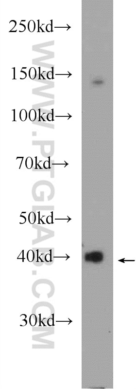 WB analysis of mouse liver using 25056-1-AP