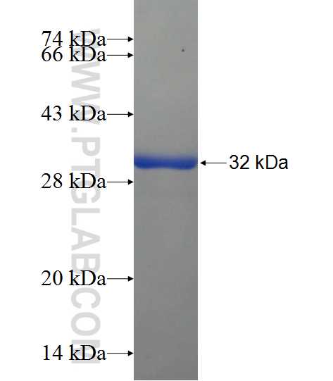 HAO1 fusion protein Ag21884 SDS-PAGE