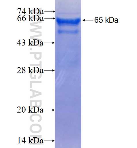 HAO2 fusion protein Ag9838 SDS-PAGE