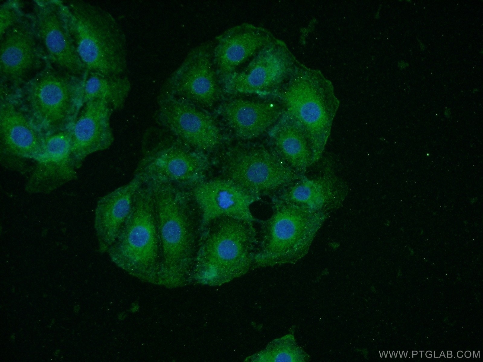 Immunofluorescence (IF) / fluorescent staining of SH-SY5Y cells using HAP1 Polyclonal antibody (25133-1-AP)