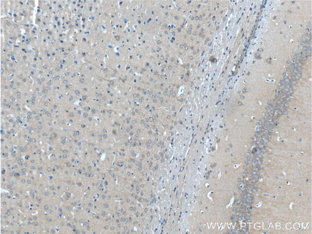 Immunohistochemistry (IHC) staining of mouse brain tissue using HAP1 Polyclonal antibody (25133-1-AP)