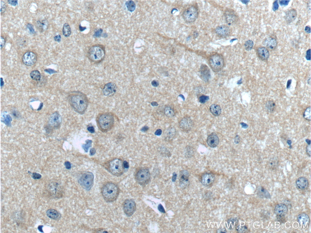 Immunohistochemistry (IHC) staining of mouse brain tissue using HAP1 Polyclonal antibody (25133-1-AP)