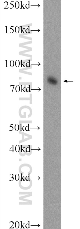 Western Blot (WB) analysis of fetal human brain tissue using HAP1 Polyclonal antibody (25133-1-AP)