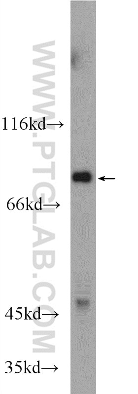 Western Blot (WB) analysis of fetal human brain tissue using HAP1 Polyclonal antibody (25133-1-AP)