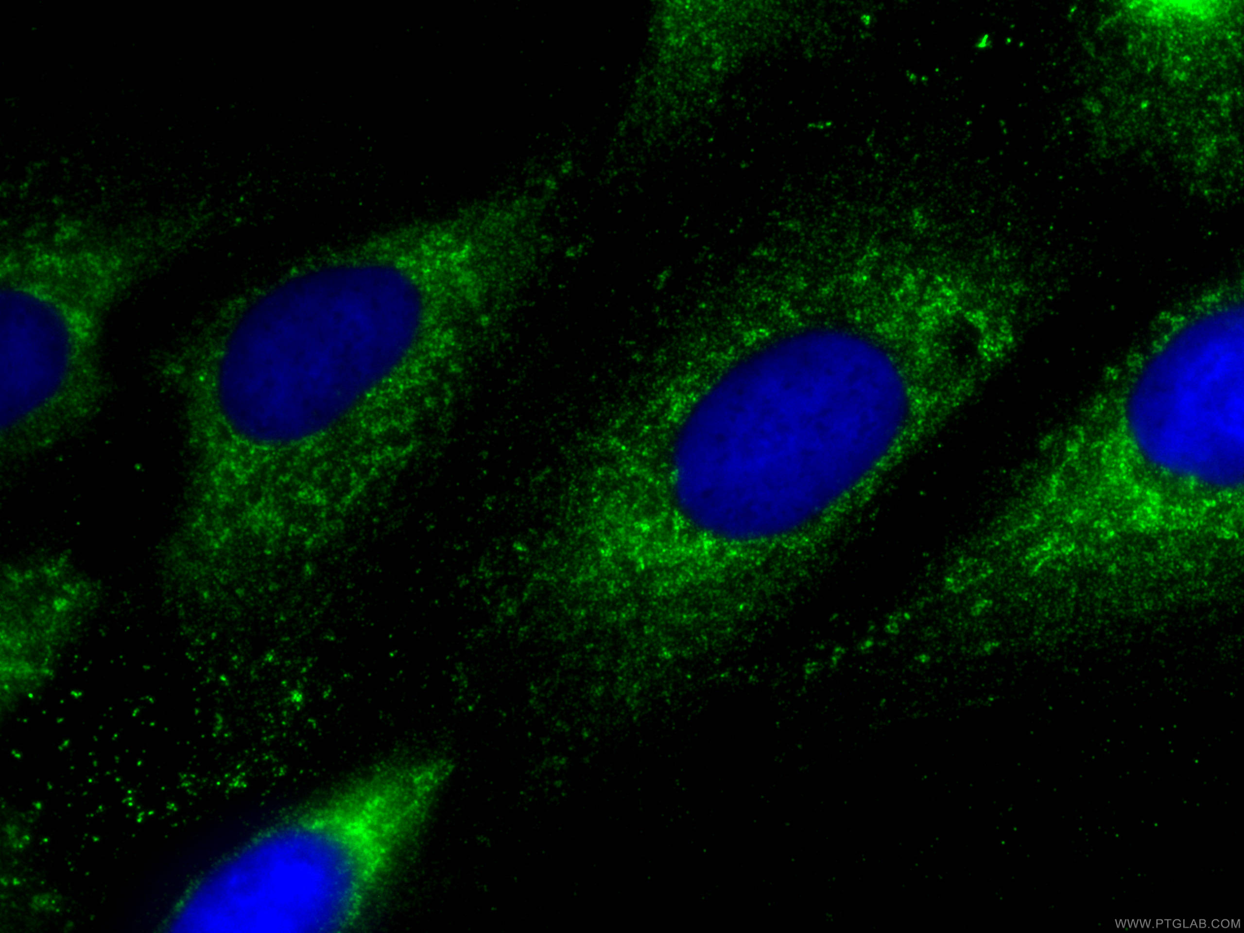 Immunofluorescence (IF) / fluorescent staining of U2OS cells using HAPLN1 Polyclonal antibody (26831-1-AP)