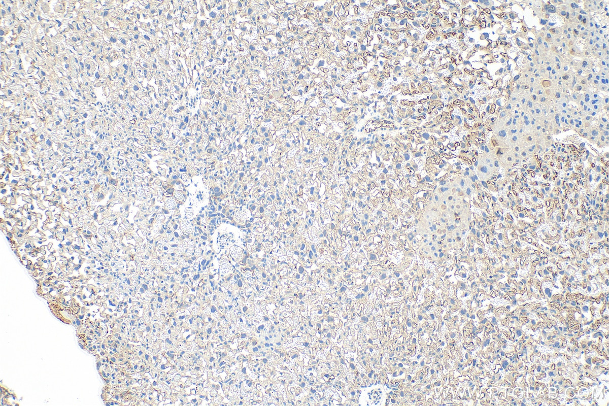 Immunohistochemistry (IHC) staining of mouse placenta tissue using HAPLN1 Polyclonal antibody (26831-1-AP)