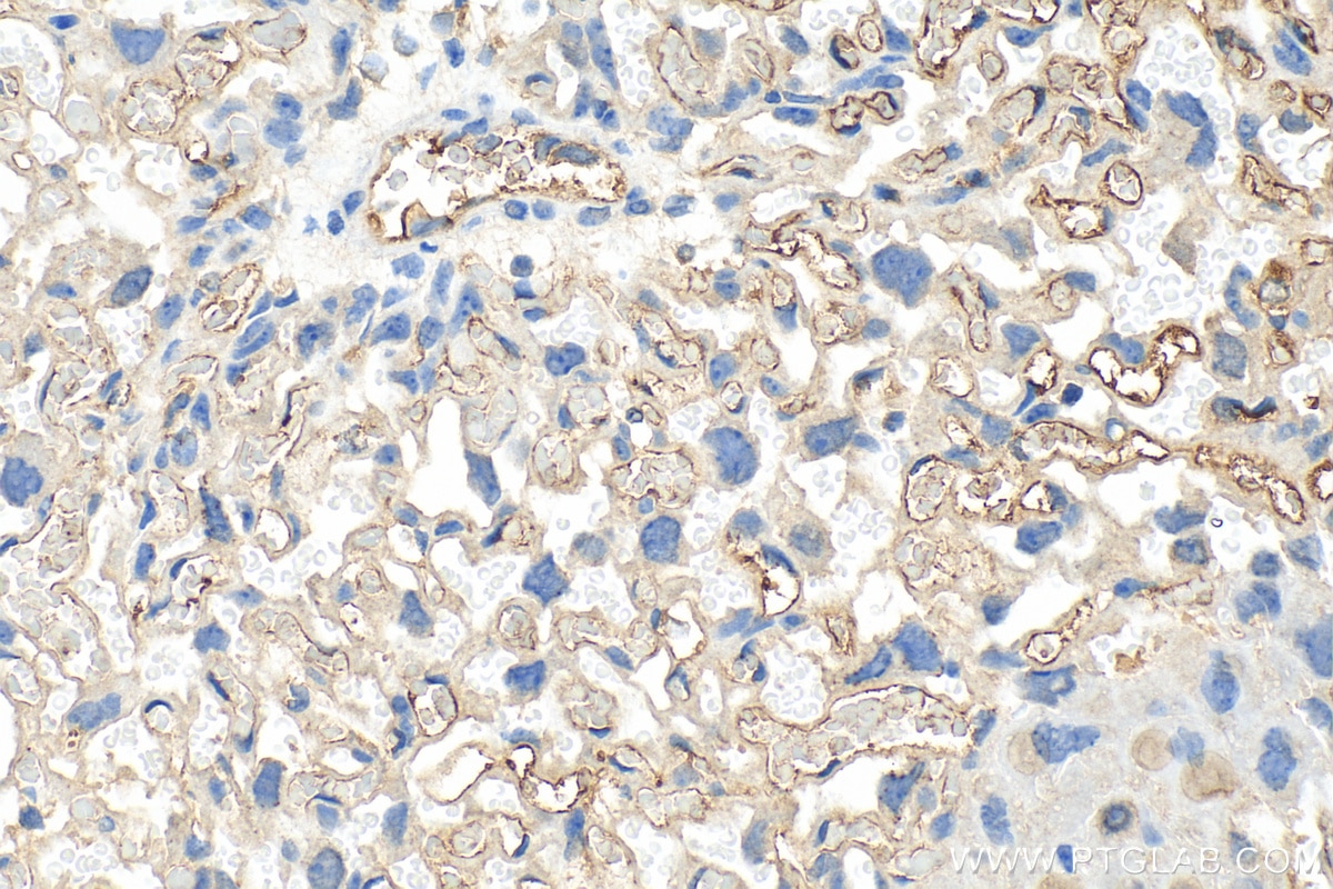 Immunohistochemistry (IHC) staining of mouse placenta tissue using HAPLN1 Polyclonal antibody (26831-1-AP)