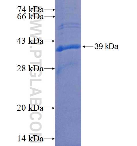 HAPLN1 fusion protein Ag25221 SDS-PAGE