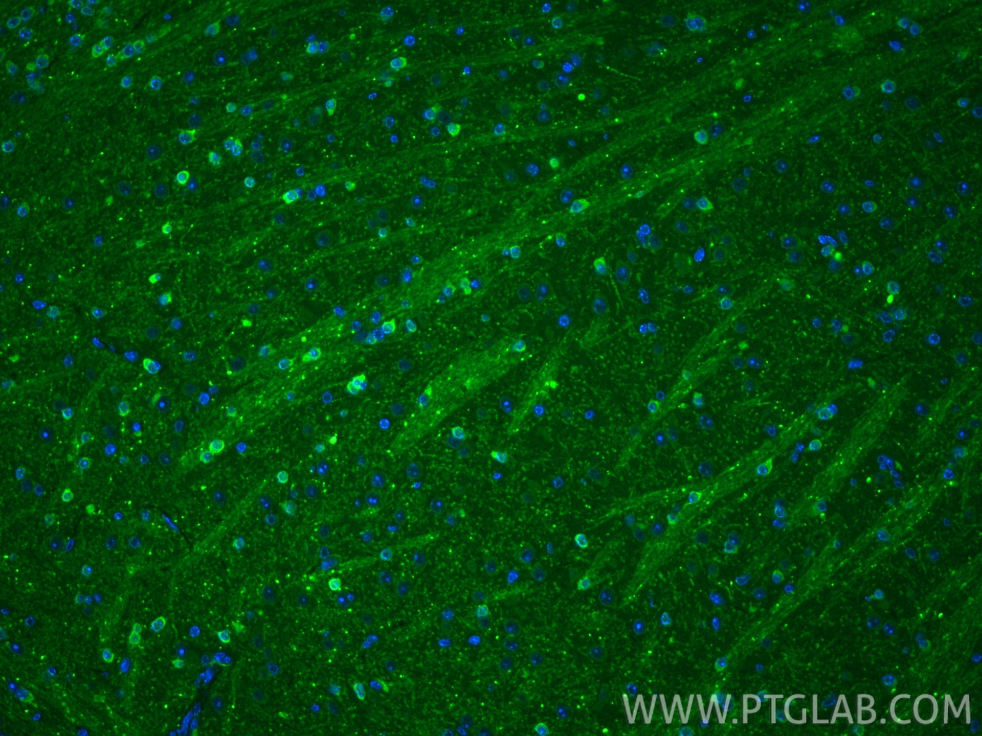 IF Staining of mouse brain using 27818-1-AP (same clone as 27818-1-PBS) Immunofluorescence (IF) / fluorescent staining of mouse brain tissue using HAPLN2 Polyclonal antibody (27818-1-AP)