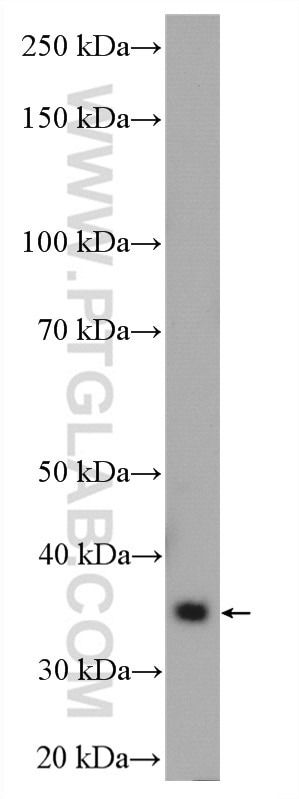 Western Blot (WB) analysis of rat brain tissue using HAPLN2 Polyclonal antibody (27818-1-AP)